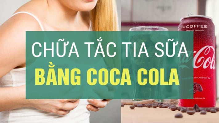 Chữa tắc tia sữa bằng coca cola
